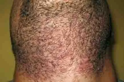 Before and After